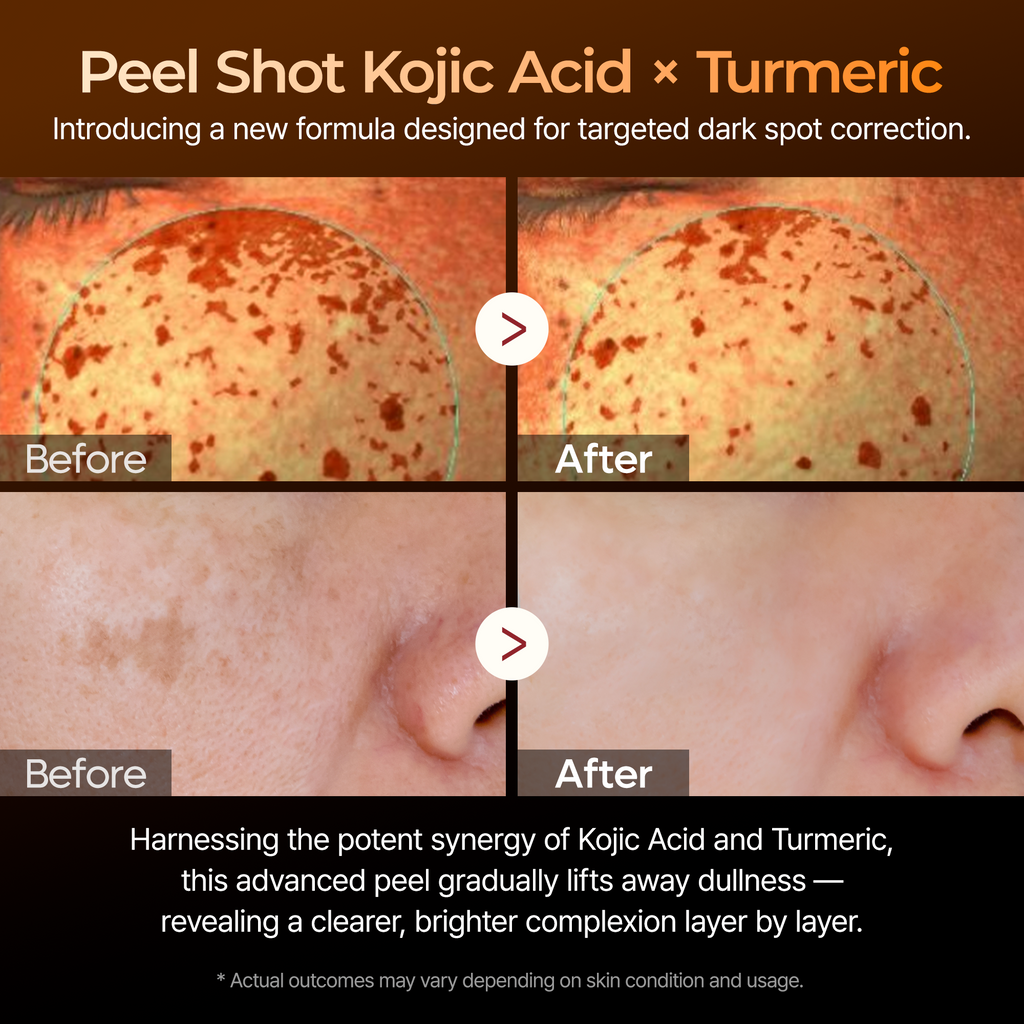 Peel Shot Kojic Acid Turmeric Serum — 3