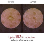 Dr Melaxin Peel Shot — 5