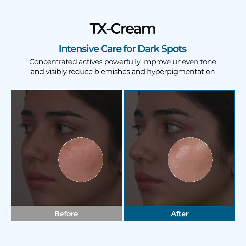 TX Cream — 4