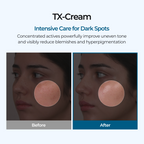 TX Cream — 4