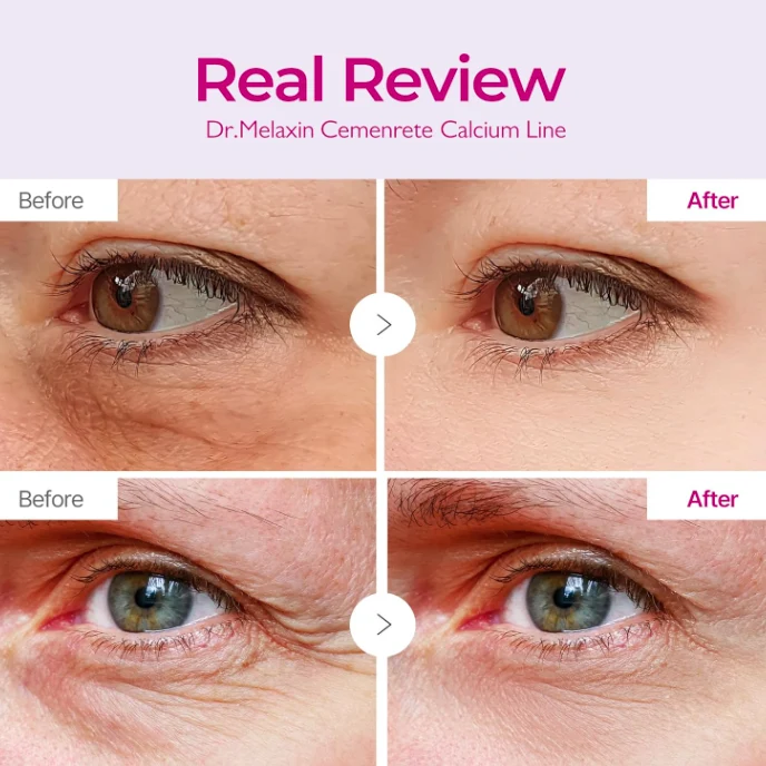 Dr. Melaxin Cemenrete Calcium Volume Eye Patch — 3
