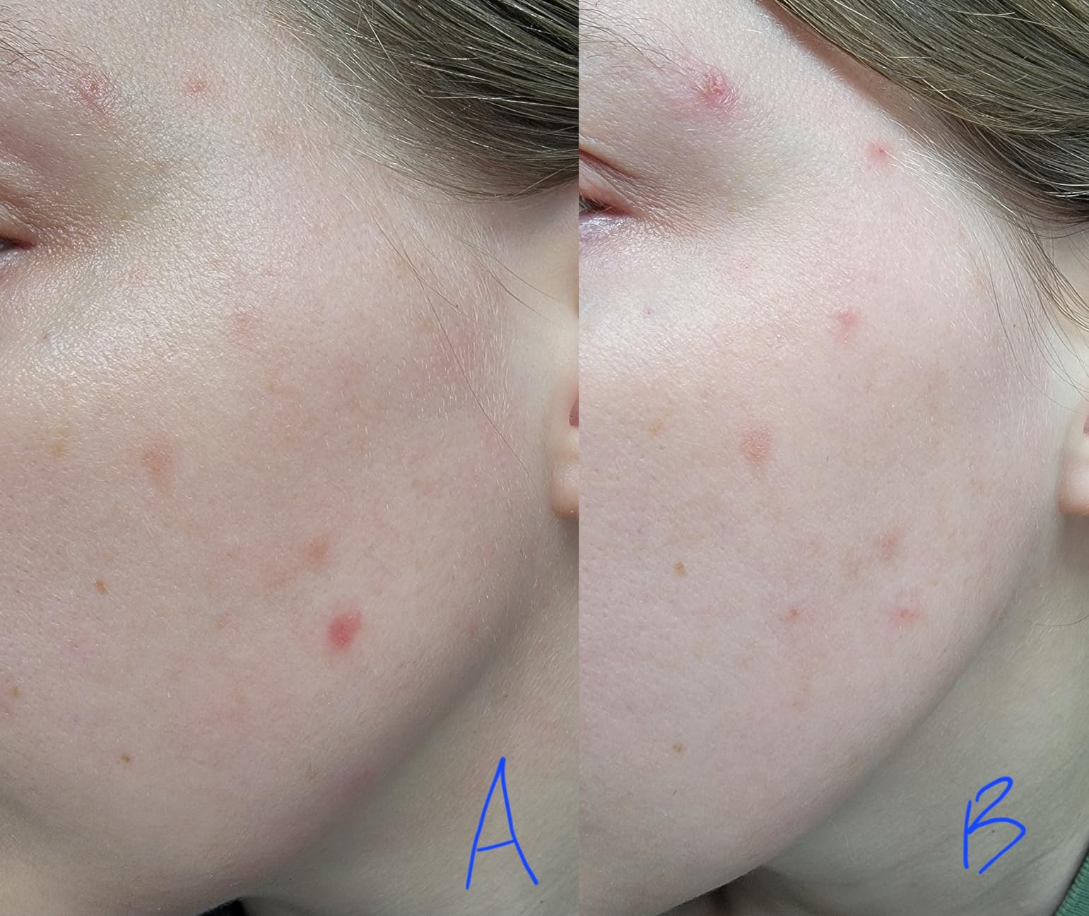 Review photo